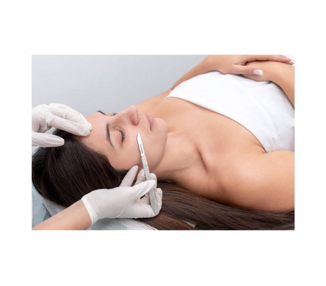 dermaplanning in rockwall tx