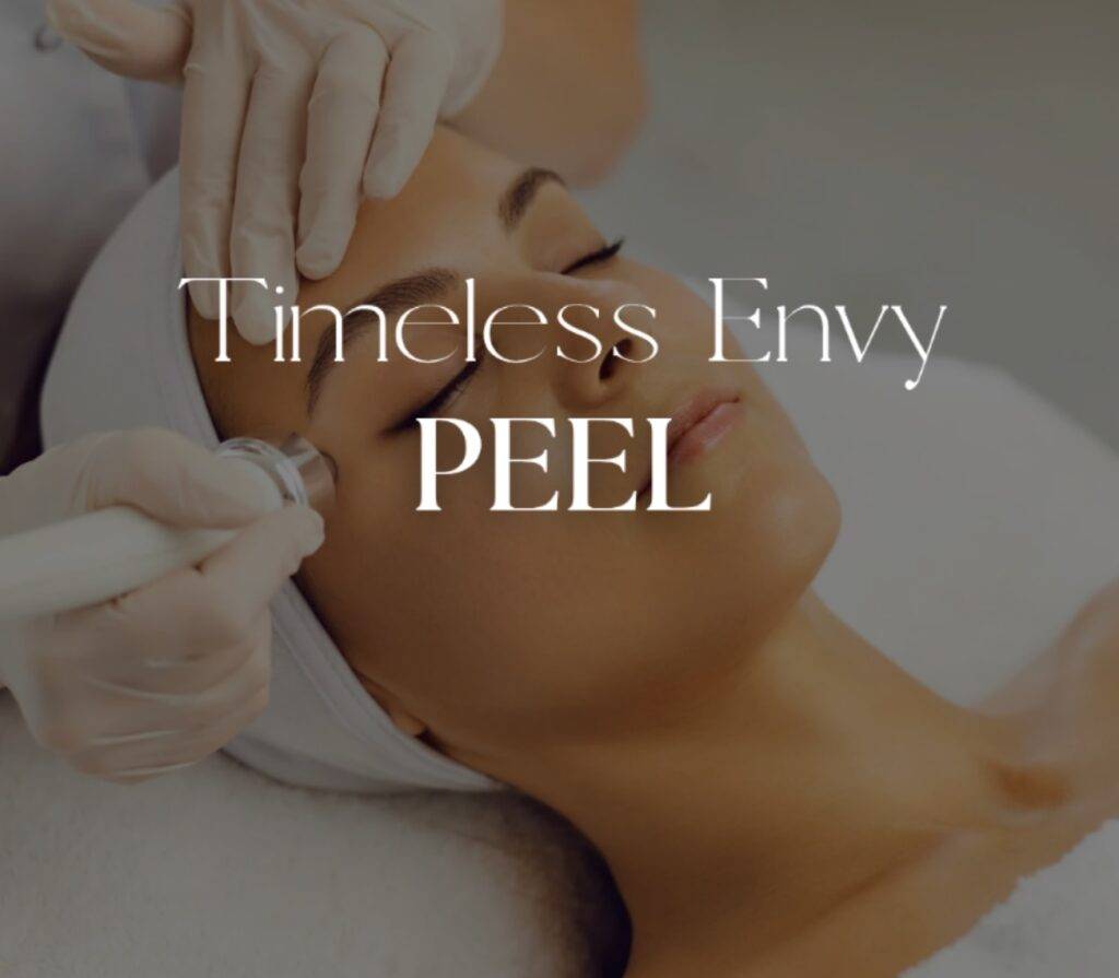 timeless envy peel