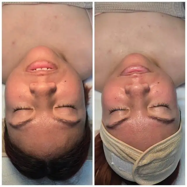 face and body envy rockwall