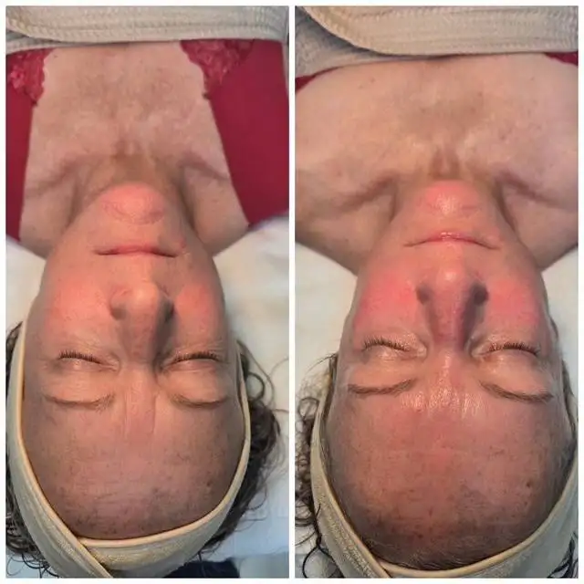 face and body envy rockwall tx