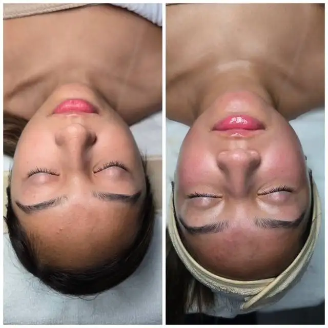 face and body envy tx