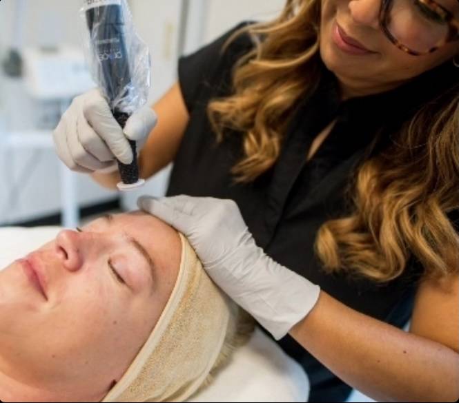 micro channeling in rockwall tx